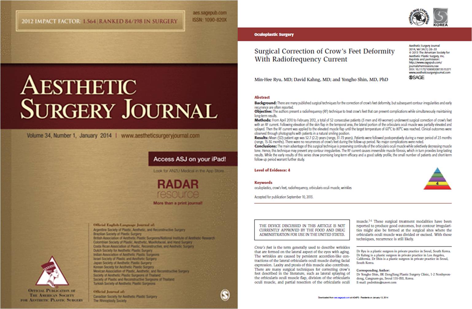 Aesthetic Surgery Journal 2014 &mdash; Surgical Correction of Crow's Feet Deformity With Radiofrequency Current, Min-Hee Ryu